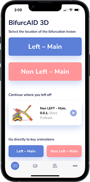 Mockup - BifurcAID3D